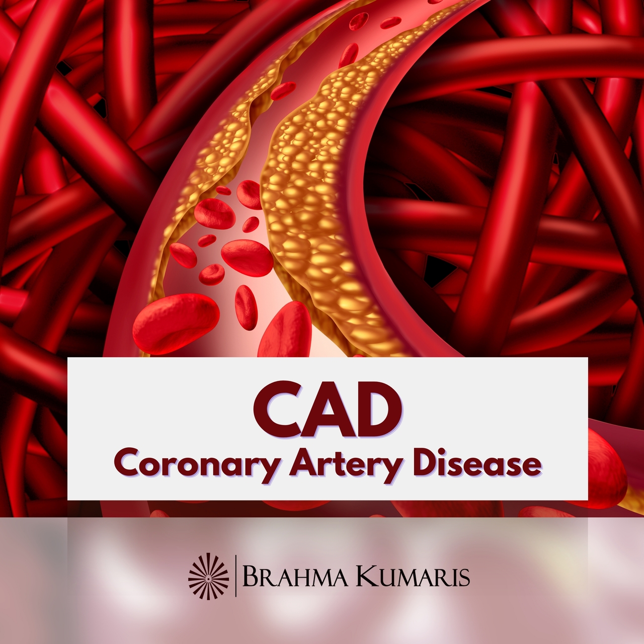 CAD